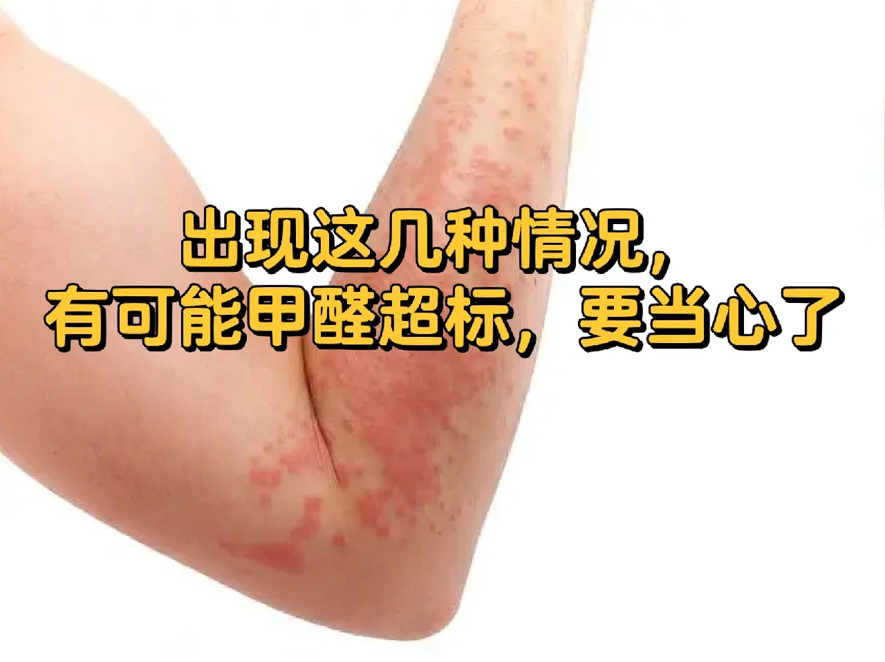 搬家后出现这几种反应，是危险信号，别不在意！